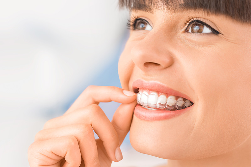 Invisalign in Salt Lake City