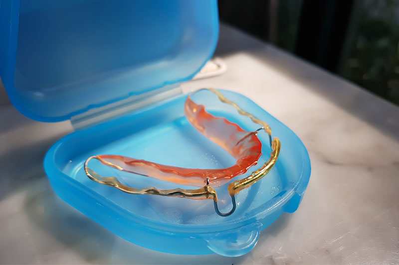 Retainers in Salt Lake City