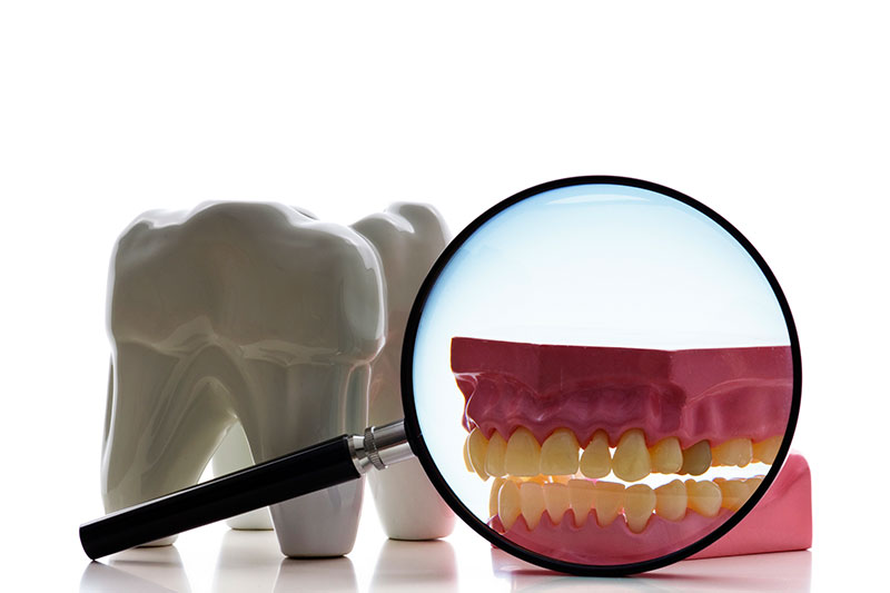 Root Canal Treatment in Salt Lake City